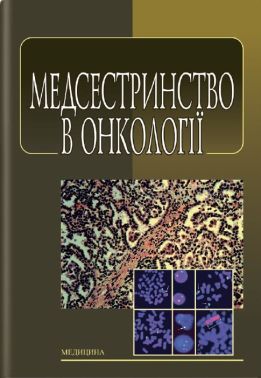 Медсестринство в онкології: підручник (ЗНЗ І—ІІІ н. а.) / Л. М. Ковальчук, О. М. Парійчук, І.І. Романишин та ін.; за ред. К. М. Ковальчука. — 2-е вид., випр. - Спеціальна Книга