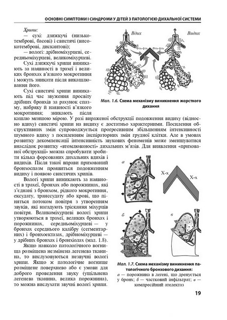 Дитяча пульмонологія. Навчальний посібник. 2-е видання - фото 5