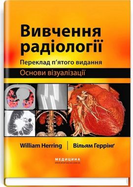 Вивчення радіології Основи візуалізації 5-е видання Авт: Вільям Геррінґ Вид-во: Медицина Вивчення радіології Основи візуалізації 5-е видання Авт: Вільям Геррінґ Вид-во: Медицина - Медицина