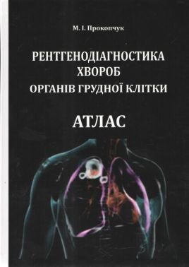 Рентгенодіагностика хвороб органів грудної клітки Атлас Авт: М.І. Прокопчук Вид-во: Видавництво Бона - Медицина